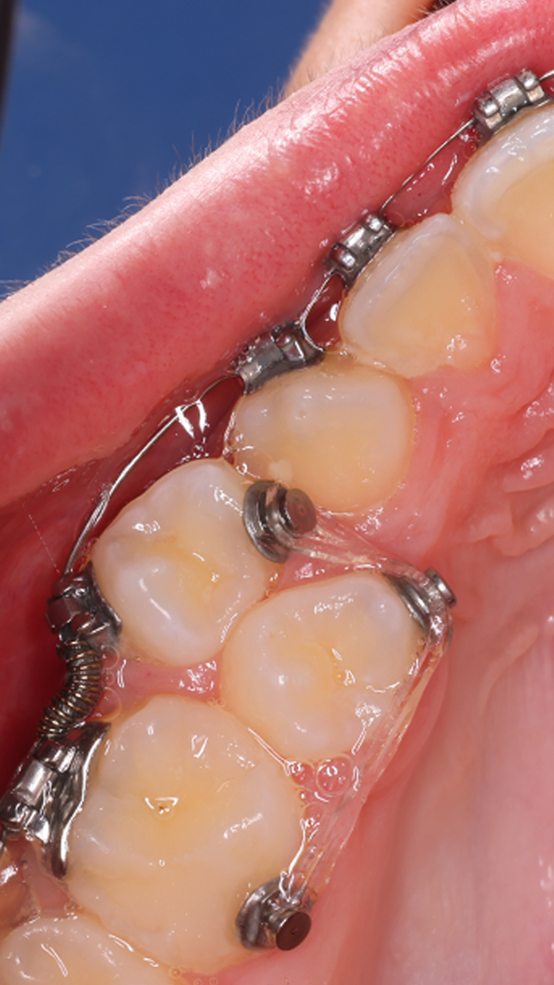 Регенерация